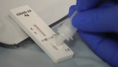 RT-PCR Test