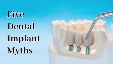 teeth implants near me