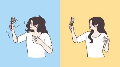 Hair Loss