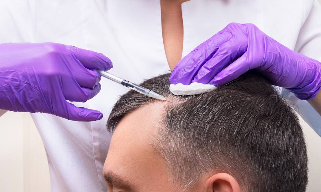 PRP Therapy
